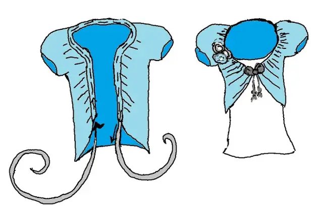 Alteración de ĉemizoj en eleganta kostumo - rapide kaj justa