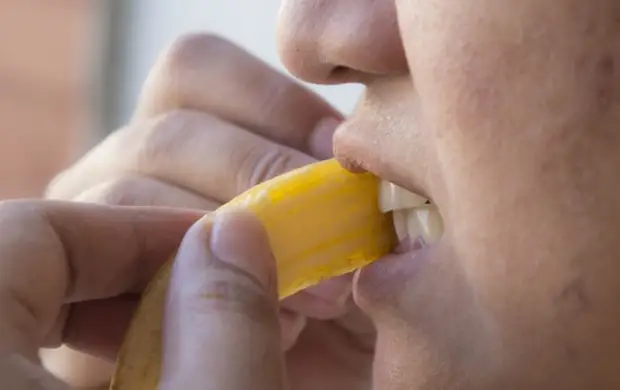 9 trucos para blanquear os dentes sen saír de casa