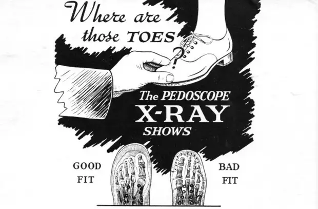 20th صدی کے پہلے نصف میں، فٹنگ کے جوتے کے دوران، ٹانگوں نے پاؤں ایکس رے، جوتے، رینن کو نشانہ بنایا