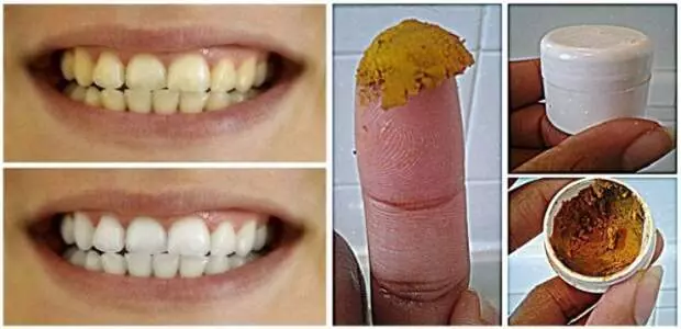 Dentes seguros branqueamento em casa - receita interessante