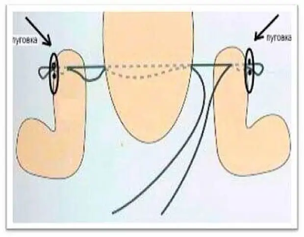 एक प्यारा कपड़े बनी कैसे सिलाई के लिए। प्रतिरूप