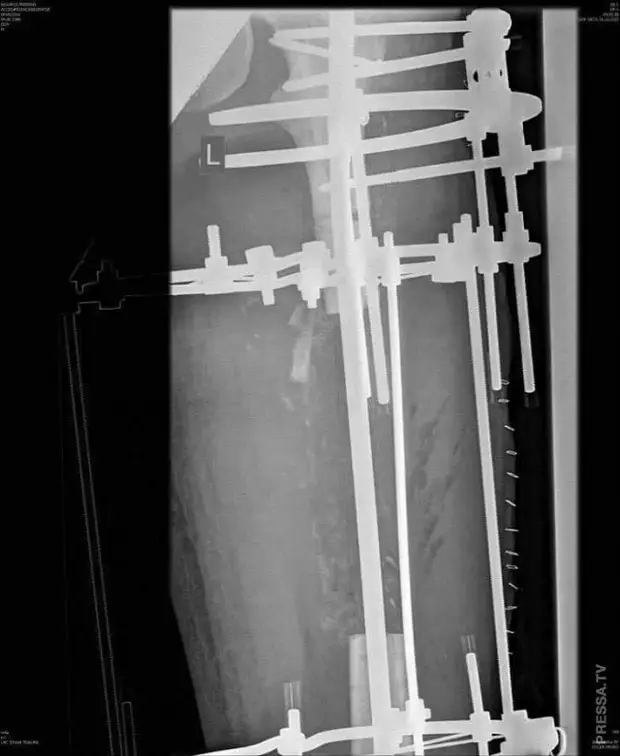 Abflugproduktion. Biker machte ein Messer aus seinem Femoralknochen